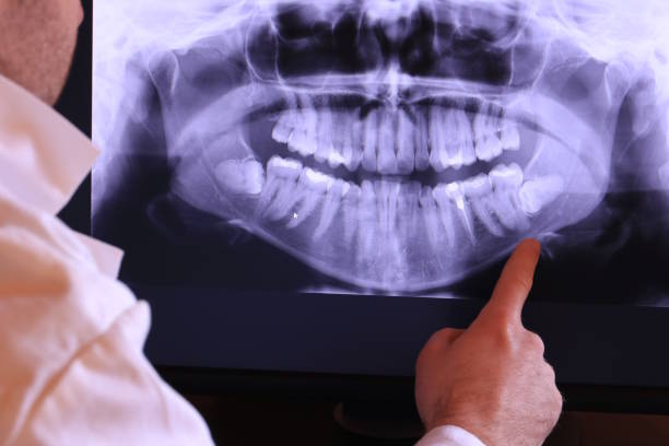 Best Weekend Emergency Dentist in Hanscom Af, MA