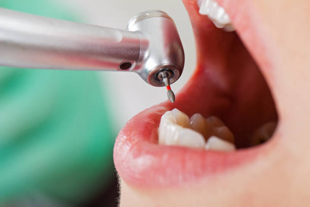 Best Same-Day Emergency Dental Services in Hanscom Af, MA